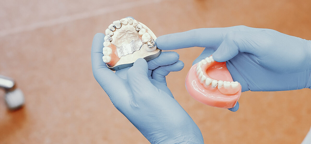 Everything You Need to Know About Dentures