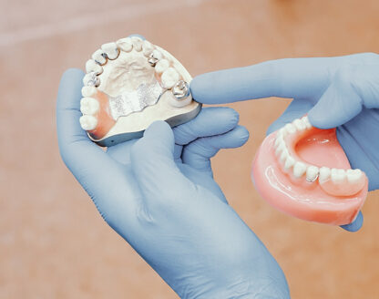 Everything You Need to Know About Dentures 