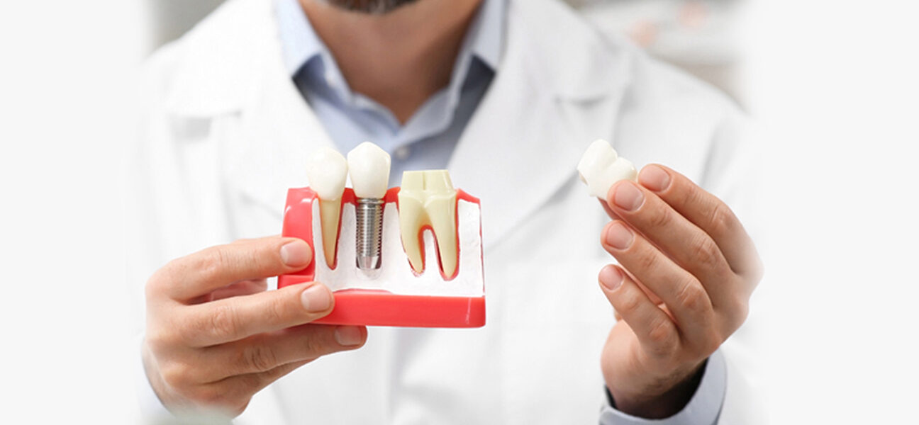Empower Your Bite: Rediscover the Joy of Eating with Dental Implants
