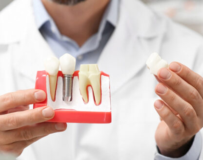 Empower Your Bite: Rediscover the Joy of Eating with Dental Implants