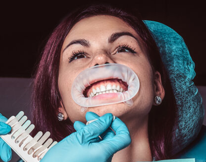 The Importance of Replacing Missing Teeth After Extraction 