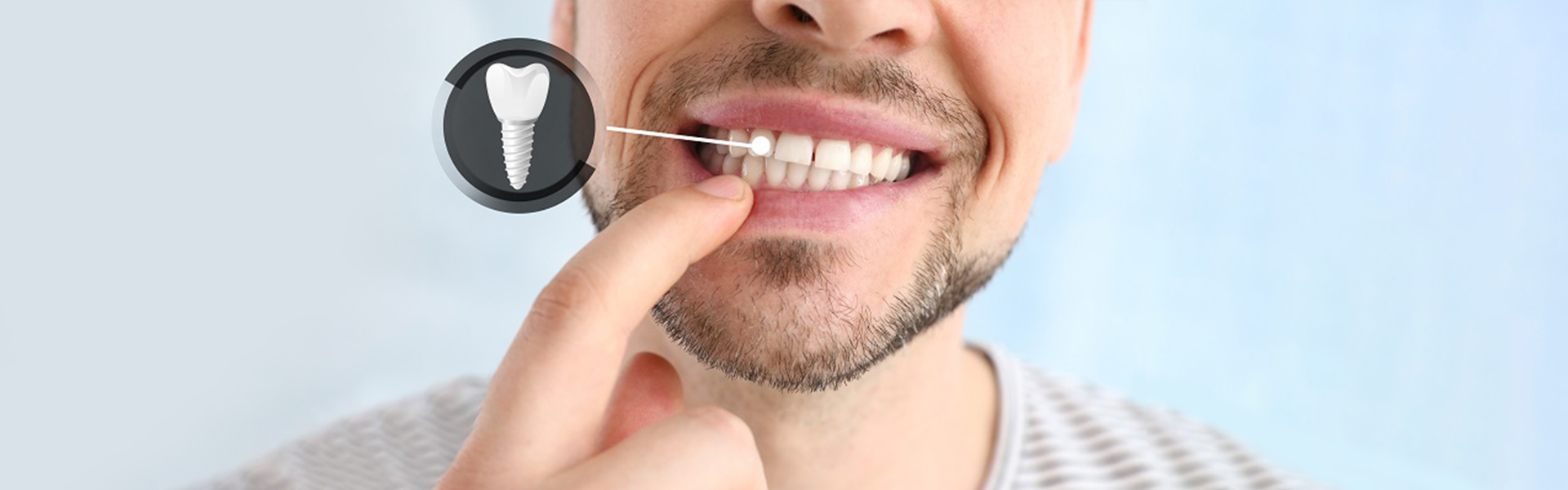How Long Do Dental Implants Last? What Lincoln Patients Should Know