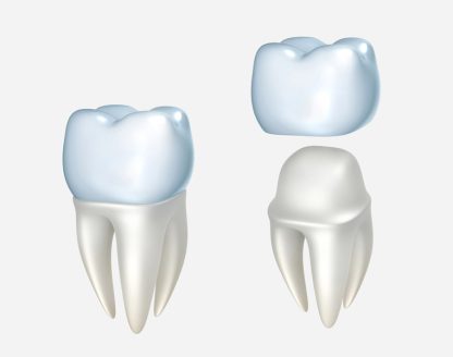 Introduction: The Unique Needs of Front Teeth 