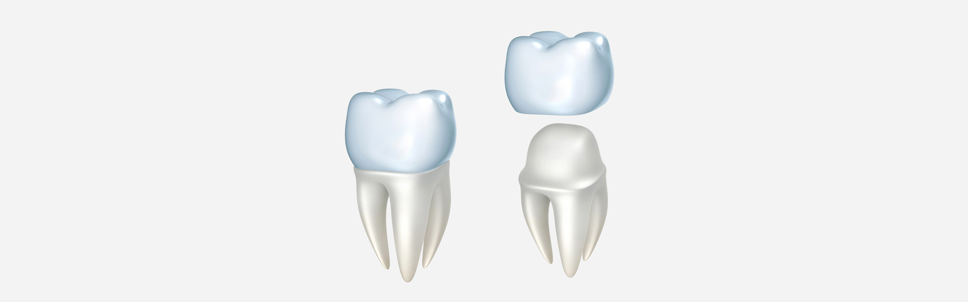 Introduction: The Unique Needs of Front Teeth